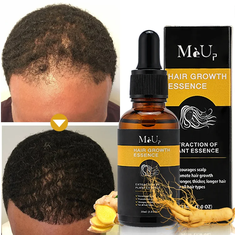 Hot Sale Private Label OEM Natural Organic Hair Treatment Serum Anti Hair Loss Hair Growth Serum Oil