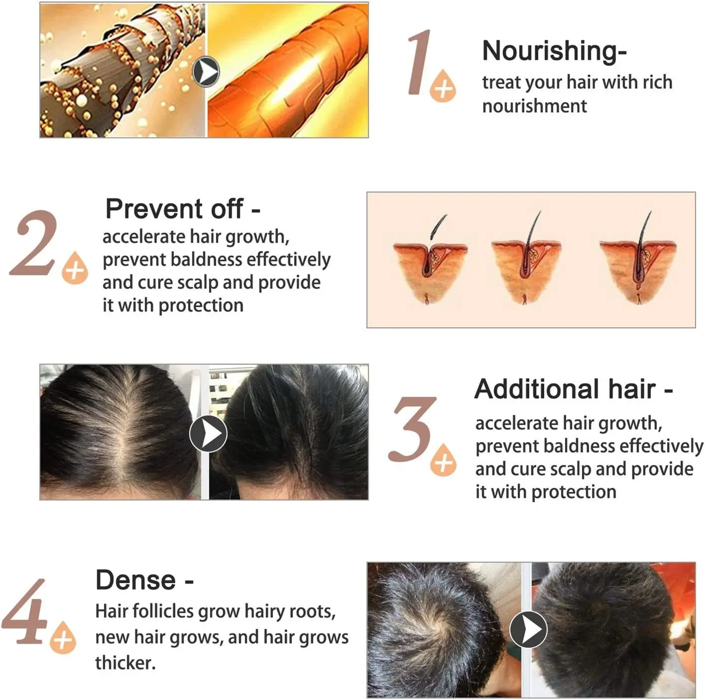 Anti Hair Loss Treatment Natural Ginger Root Melon Fast Hair Growth Serum Hair Growth Oil Serum for Men and Women