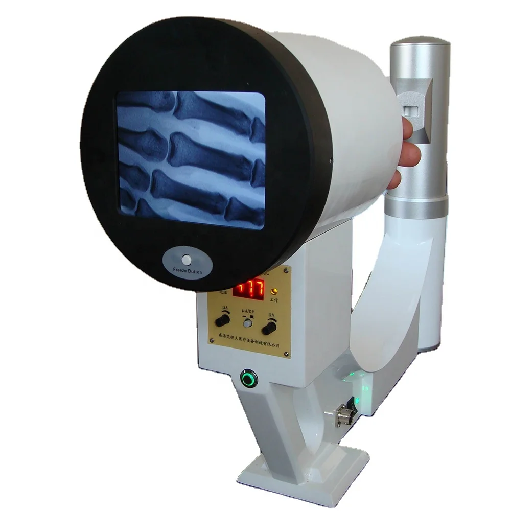 Портативный рентгеновский аппарат ручного держания, fluroscope