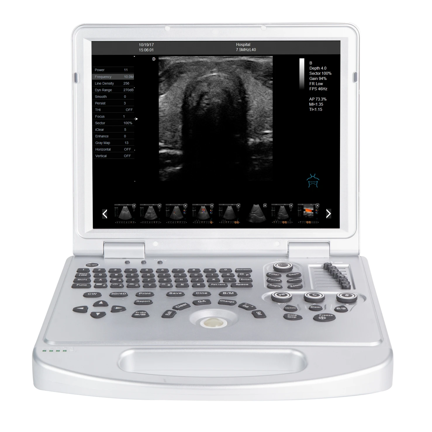 Portable echography machine/ laptop ultrasound scanner/portable echo machine color doppler