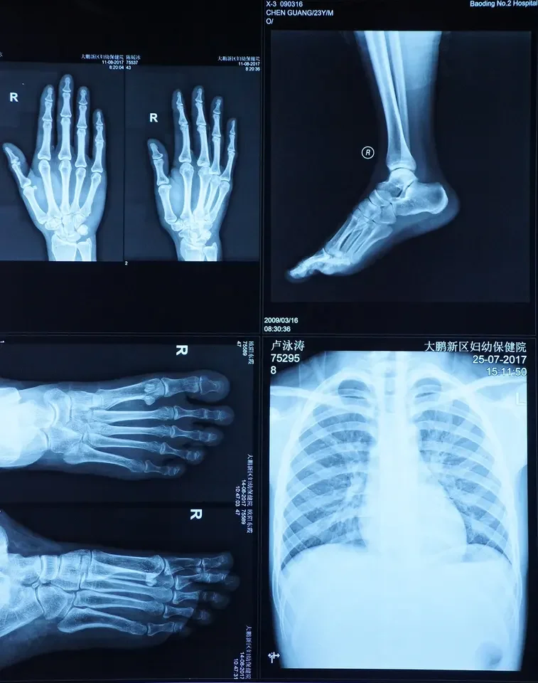 Medical X-ray film replace AGFA DT 2B to use on AGFA Drystar 5300 5302 printers