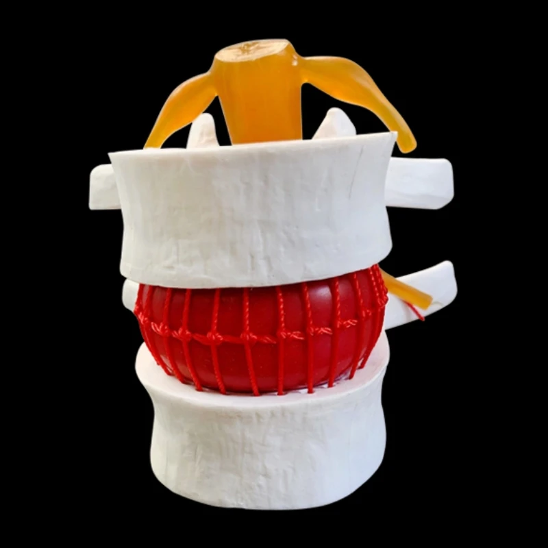 Spine Model Human spine model full size demonstration model of human lumbar intervertebral disc compression for medical teaching