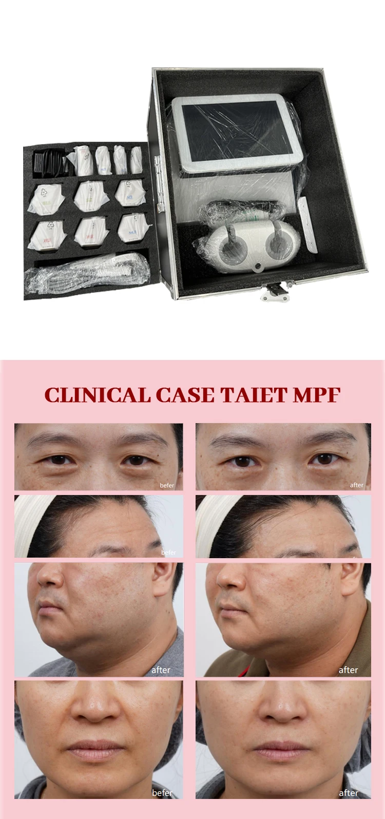 Newest 4 In 1 3d Hifu Vmax Hifu Vaginal Tightening 3d Hifus Rf Needling Fractional 4 In 1 Skin Tightening Anti-aging Machine