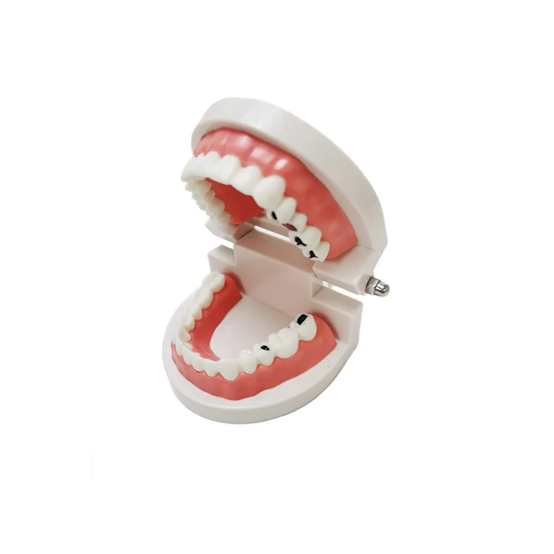 Life Size Tooth Decay Model For Oral Care Teaching Dental Tooth Care Model For Kids