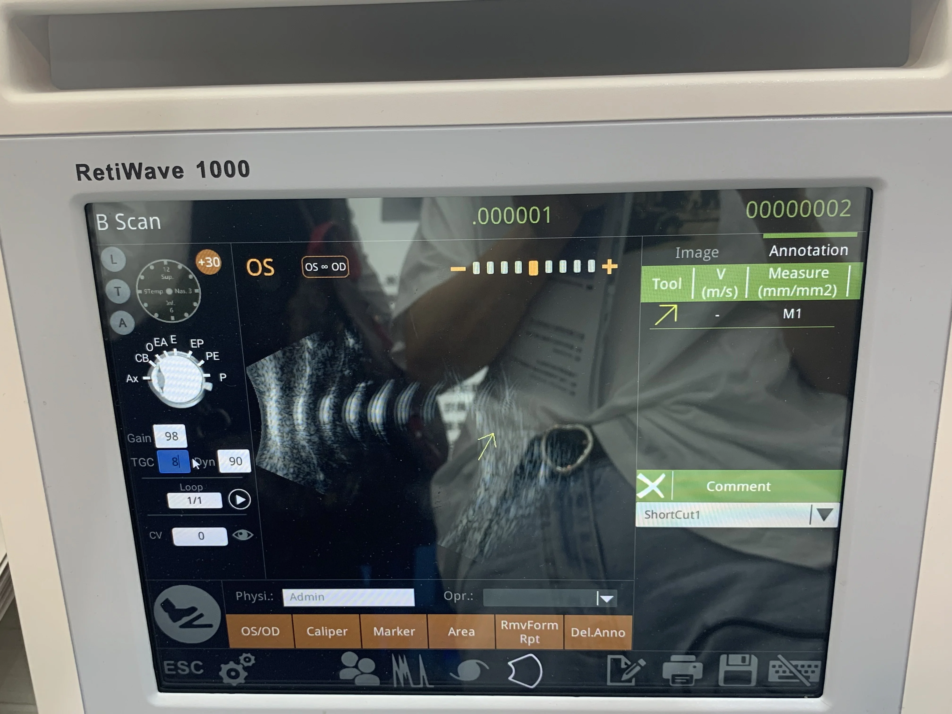  Китай новый дизайн ультразвуковой A/B сканер retiwave 1000 для