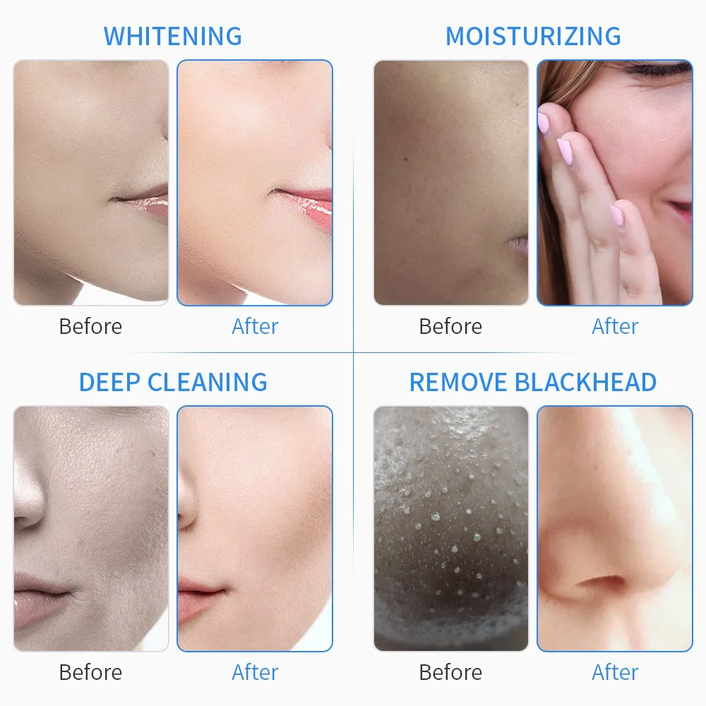 Аппарат hydraface 6 в 1 решения для цена на машины