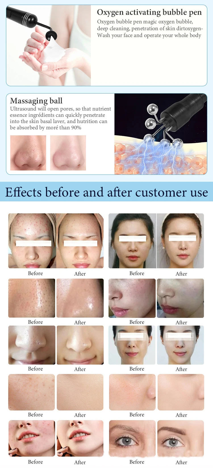 New arrival multifunctional acne removal water oxygen hydro facial peeling deep cleaning whitening machine