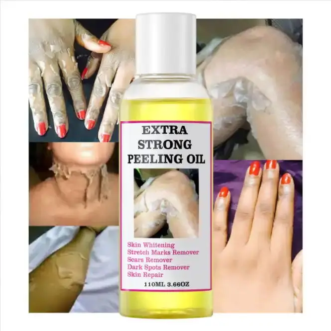 Best sale anti stretch marks multiple functions wholesale eternalelinor yellow peeling oil customized