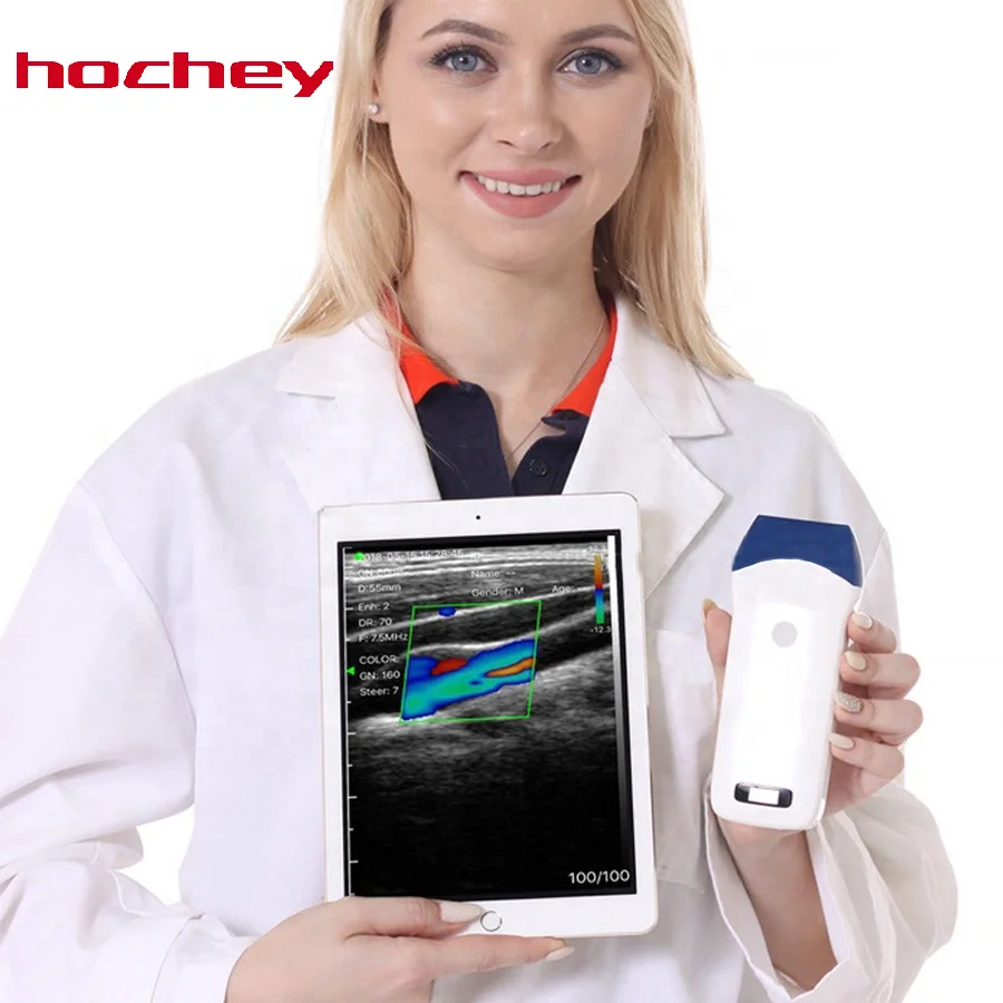 HOCHEY MEDICAL  Cheaper Price  Portable  Color  Doppler Machine Wireless Linear  Ultrasound Probe With Smart Connect Equipment