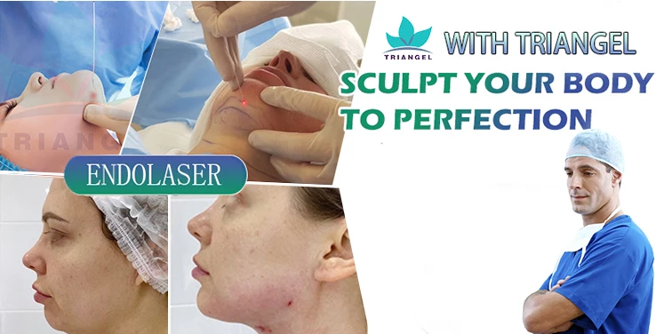 2024 newest  980nm 1470nm diode laser lipolysis endolaser face lifting  laser machine