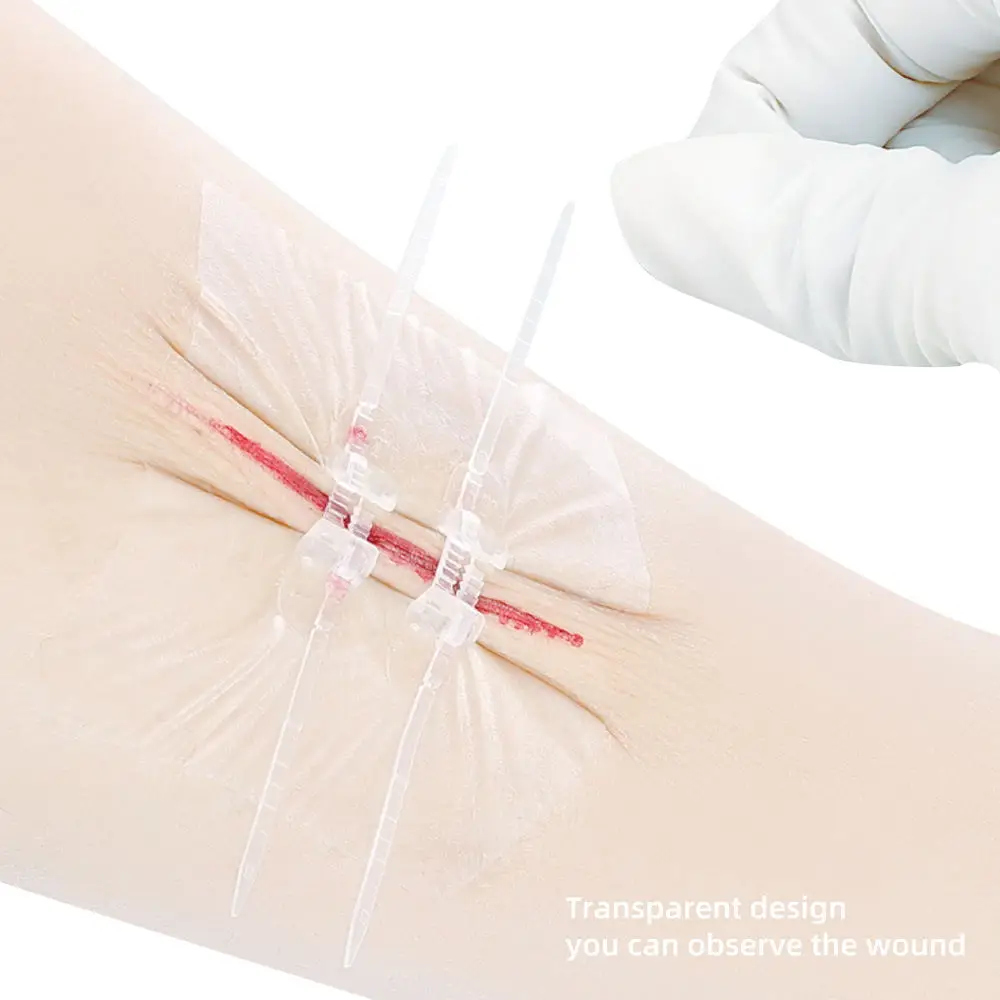 Hot Sale and Good Quality Wound Closure Device Elastic Bandage