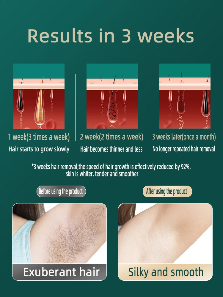 Men Woman Depilator For Body Hair Rechargeable Mini Electric Epilator Epilateur Product