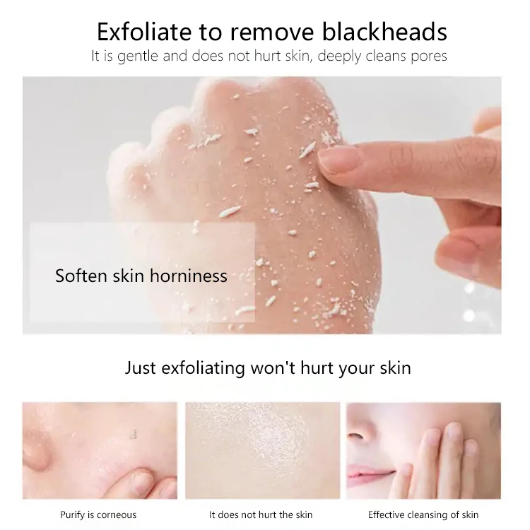 Натуральный органический отбеливающий крем для ухода за кожей лица, увлажняющий восстанавливающий крем для лечения акне, Отшелушивающий гель-крем