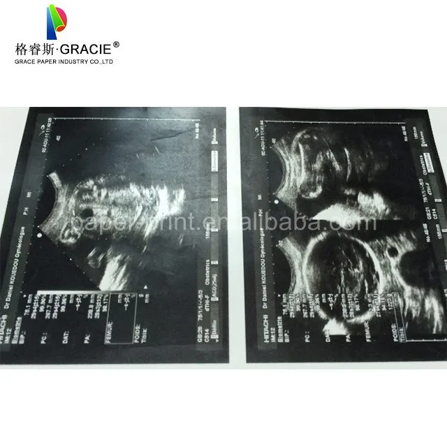 Compatible Ultrasound Paper UPP  110S for Sony video printer