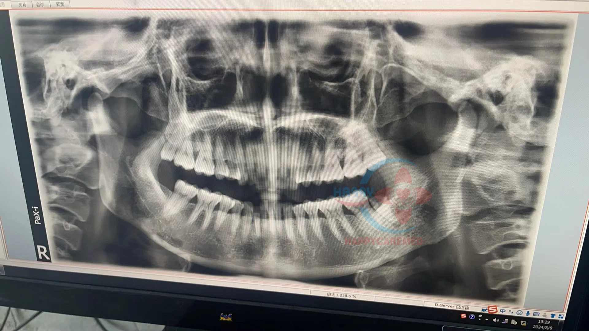 Used   Panoramic Dental  portable x ray machine
