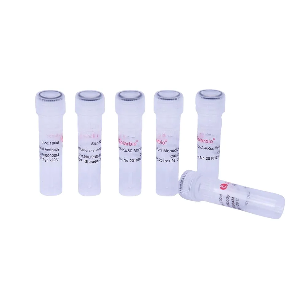 Высокое качество Anti-KDM1A моноклональное