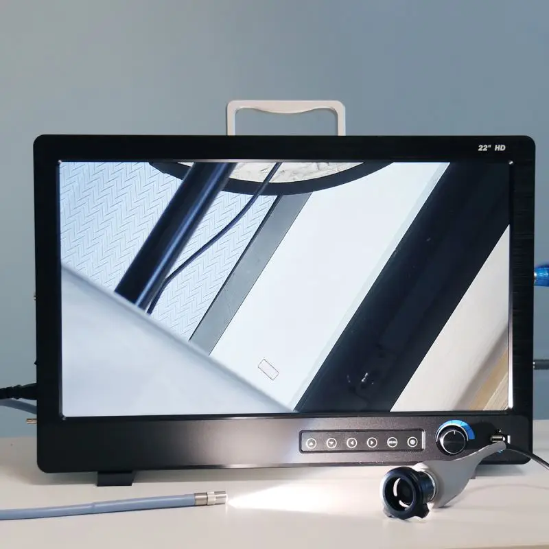 Medical ENT Endoscopy 1080P Full HD Digital Portable USB All-in-one Endoscope Camera System