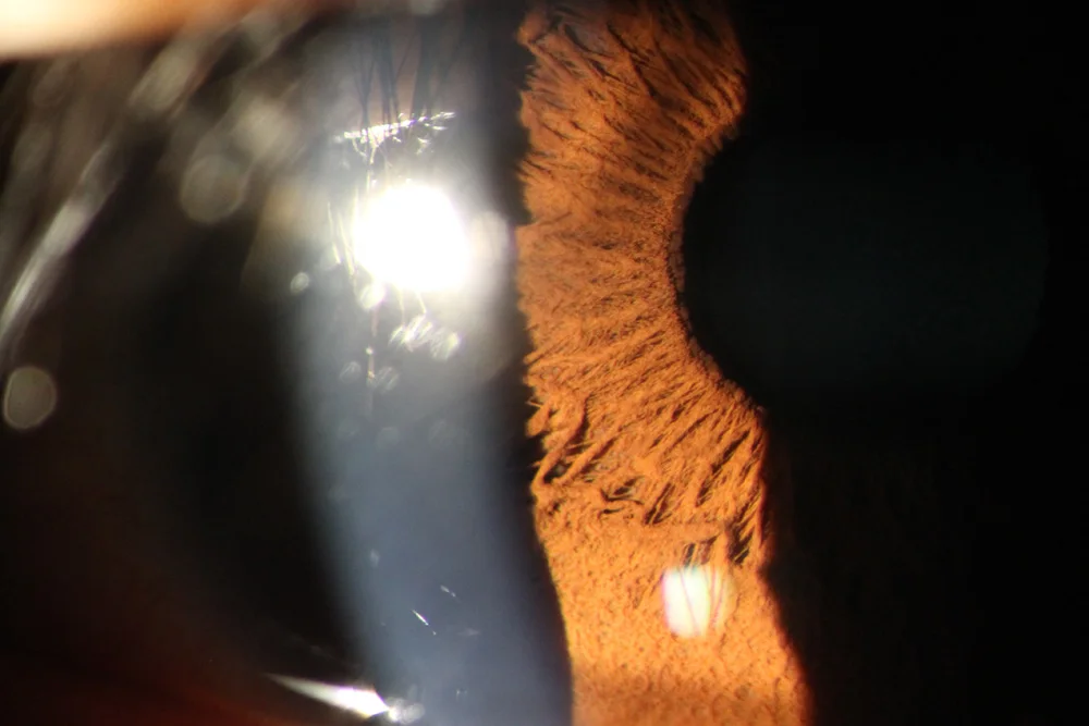 Veterinary Portable Slit Lamp Ophthalmic Examination Equipment Professional KJ5S3 Handheld Slit Lamp