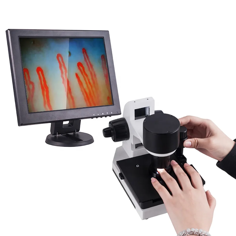 Suyzeko Advanced Nail Checking Microscope nailfold capillaroscopy with 12 inch LCD Screen