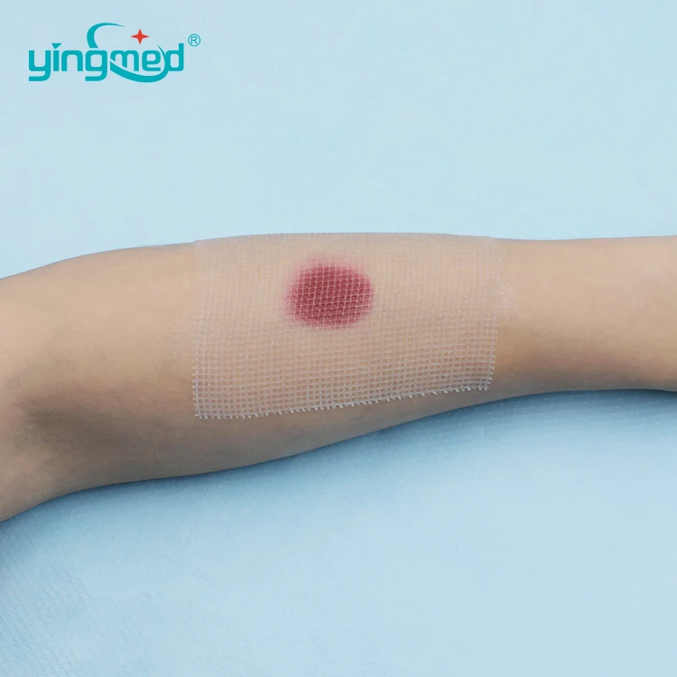 High Quality Wholesale Supply Non-adherent, Non allergenic 10cm Burn Paraffin Gauze Dressing