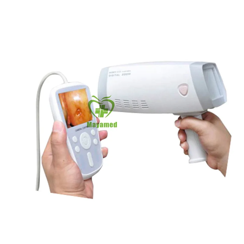 MY-F005 medical device portable handheld electronic video colposcopy equipment
