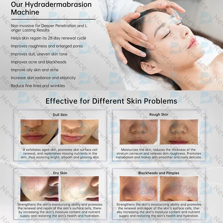 NewFace 2025 Oxygen Deep Hydration Hydrogen Facial Clean Hydro Dermabrasion H2O2 Injection Beauty Skin Care Face Hydra Machine