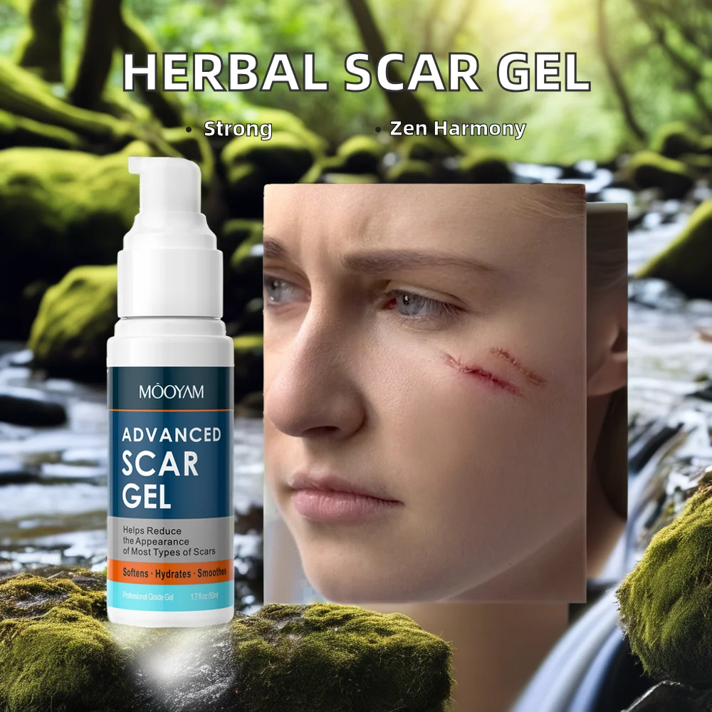 Natural Body Cream Effective Collagen Formula Herbal Gel Acne Pimple Mark Stretch Marks Scar Removal Mild Whitening Features