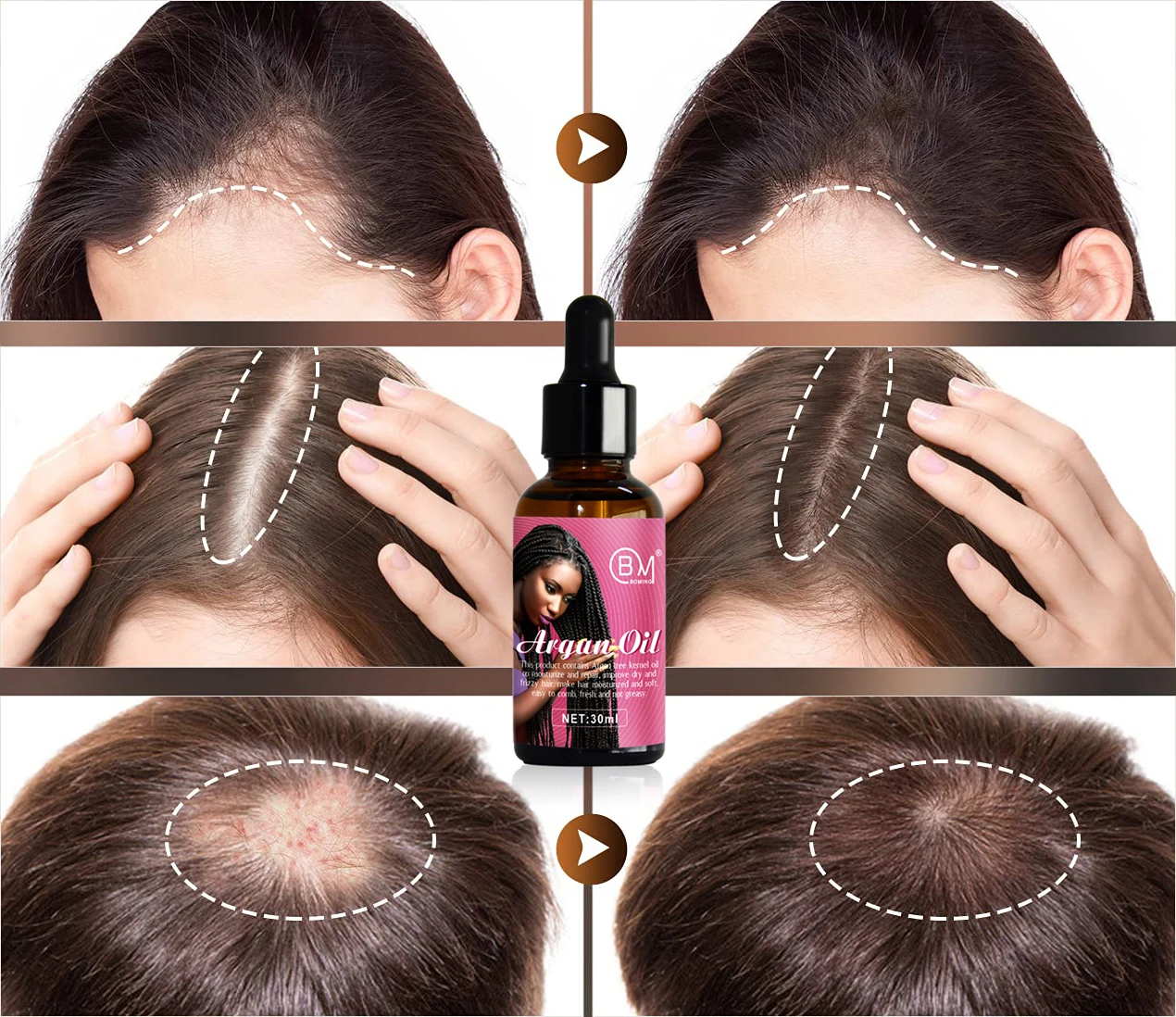 Best china hair growth oil custom logo pure  for men woman