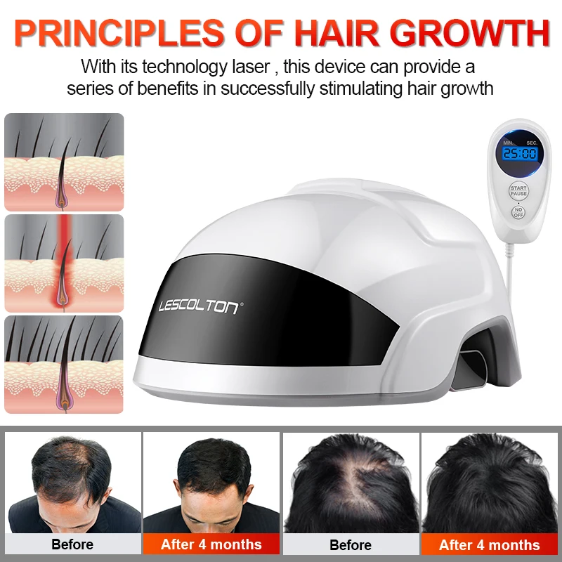 Lescolton Professional LLLT Laser Cap Restore Hair Thickness Hair Regrowth Helmet Hair Loss Treatment Device
