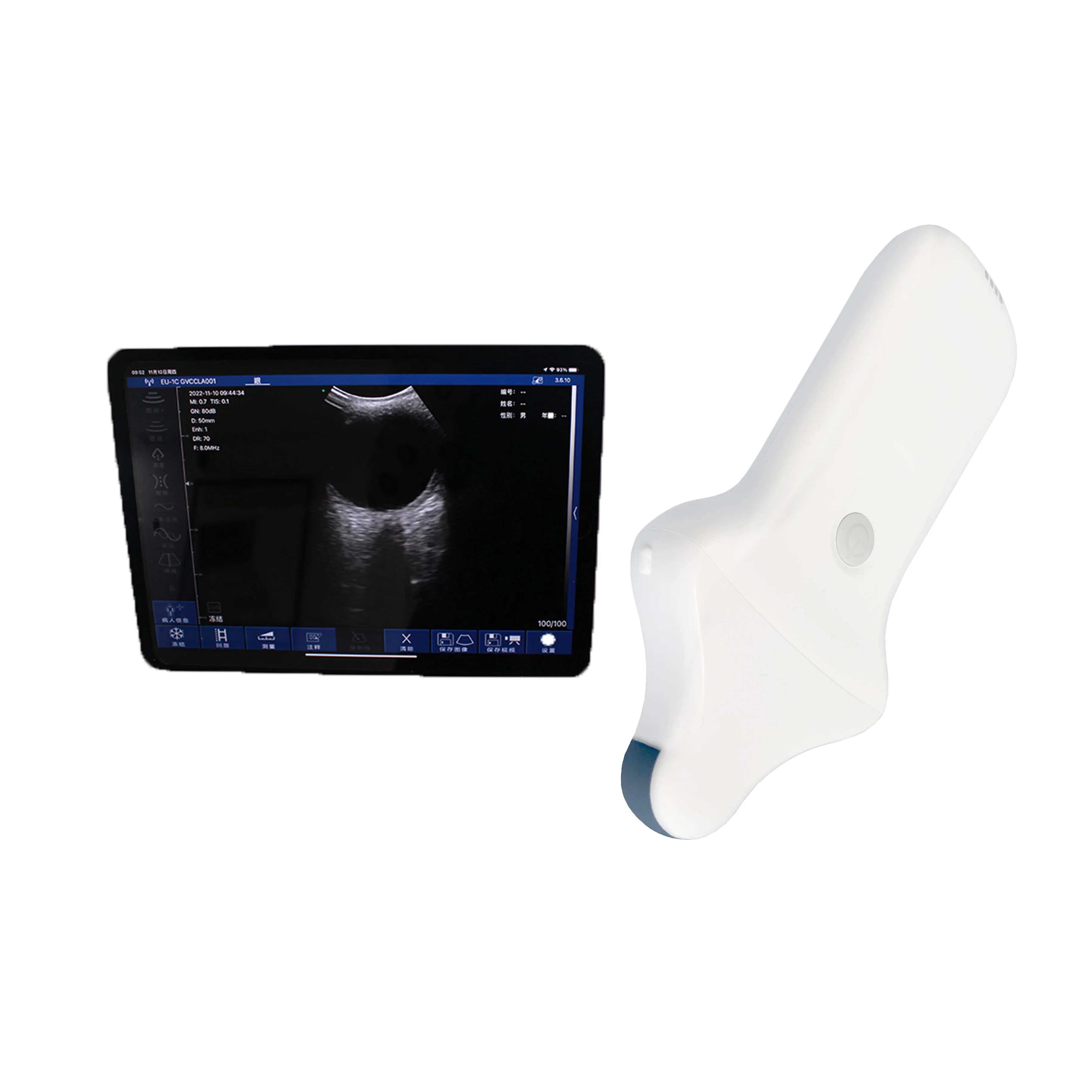 Portable Handheld WIFI Color Doppler Ultrasound Probe with Micro-convex Probe for Medical Use