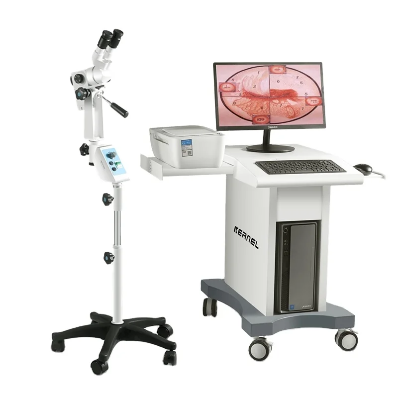 Оптический кольпоскоп с CCD-камерой гинекологический микроскоп кольпоскопия видео KN-2200BI портативный видеокольпоскоп