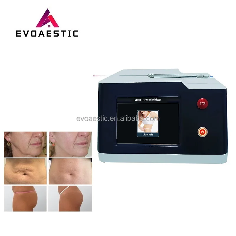 portable 980nm 1470nm diode laser liposuction endolifting facial laser for Vessel removal nail fungus removal physiotherapy