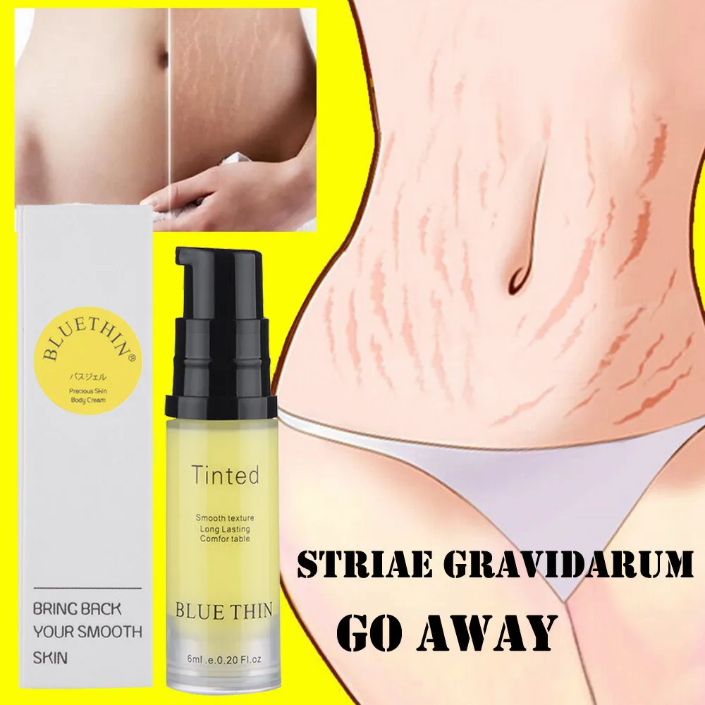 
Pregnancy Stretch Mark Removal Cream Scar Removal Gel Stretch Marks Removal Cream 