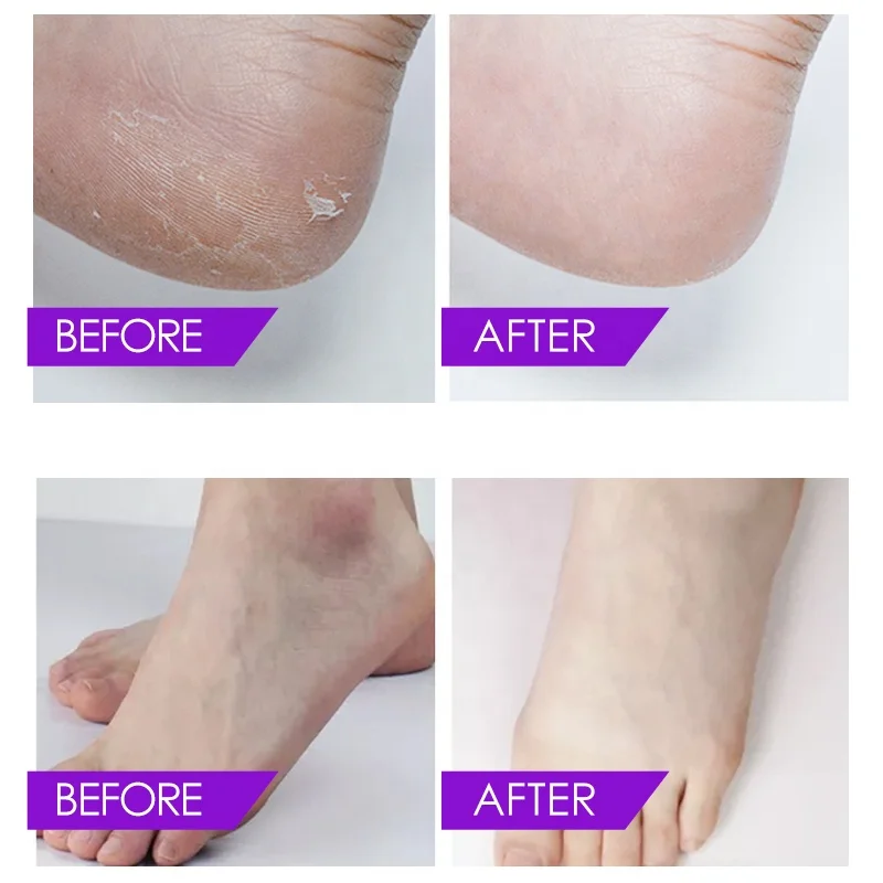Homemade Foot Spa Lavender Crystal Jelly Salt Powder Soften Whiten Foot Bath Salt DIY Cool Jelly Gel Pedicurehelly Pedicure