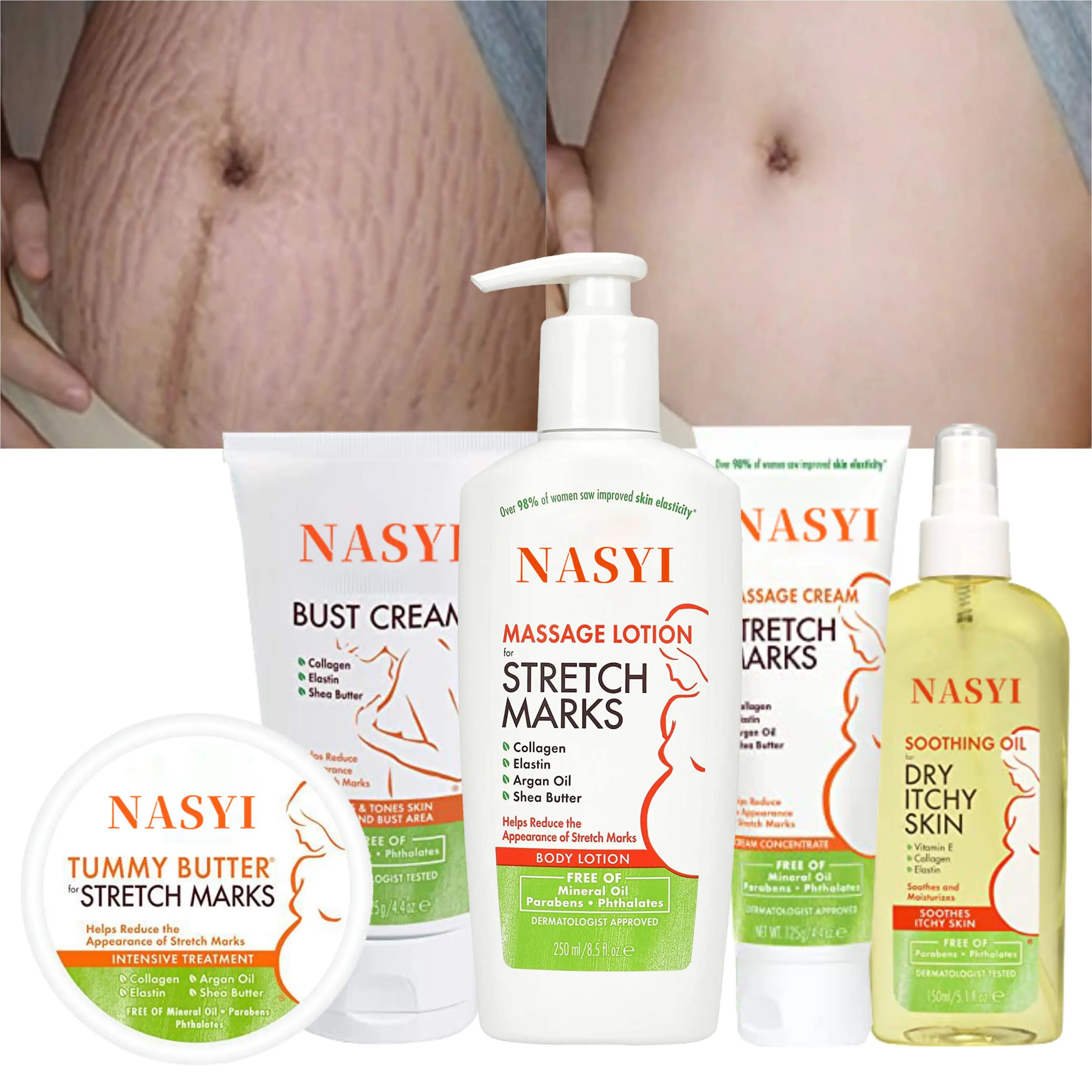 Wholesale Stretch Mark Removal Massage Lotion Pregnant Women Prenatal Care Stretch Mark Professional Skin Care Products 250Ml