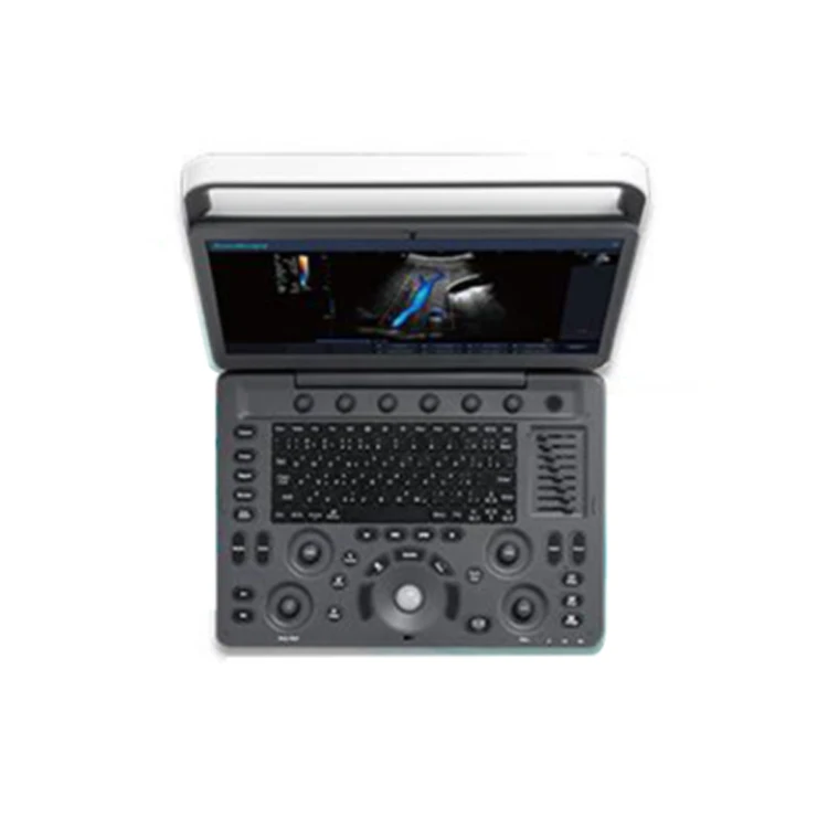 Medical Ultrasound Instruments Sonoscape E2 ultrasound With Competitive Price