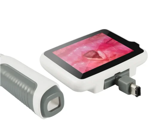 Laryngoscope Smartscope Vl PRO Hospital Medical Digital Video Laryngoscope