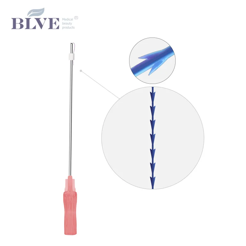 Рассасывающийся хирургический пресс для лица Blunt cannula формование рыбьей кости 3d cog pdo подтяжка