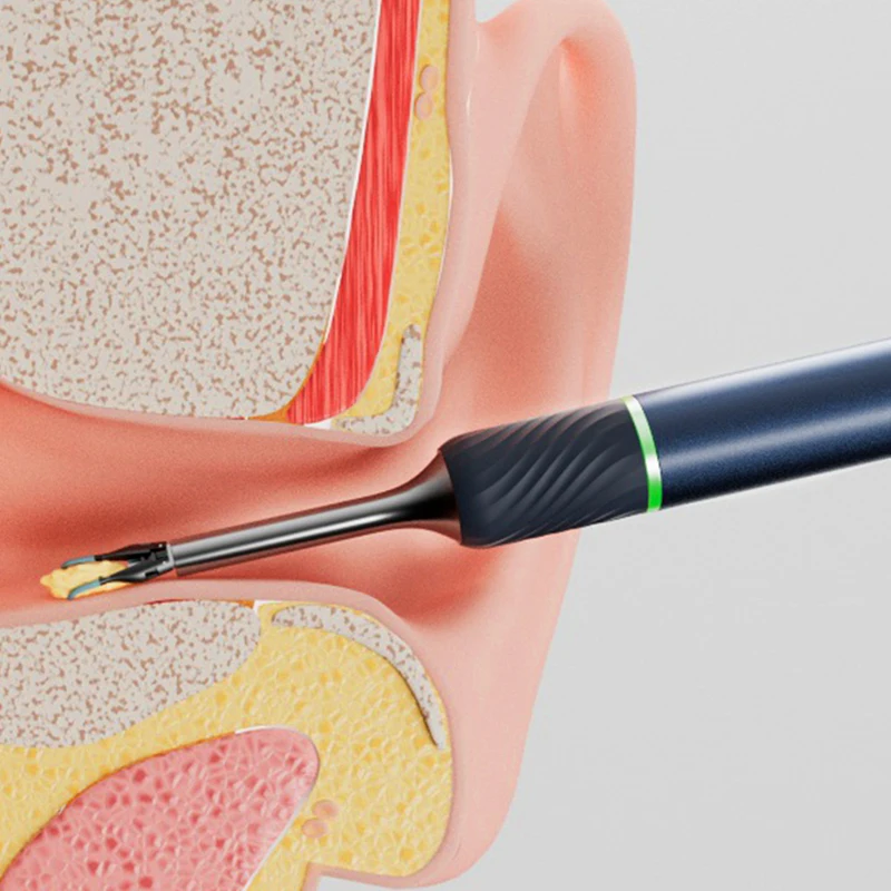 Bebird Note5 Video Otoscope Ent Diagnostic Sets with LED light ear wax removal tool