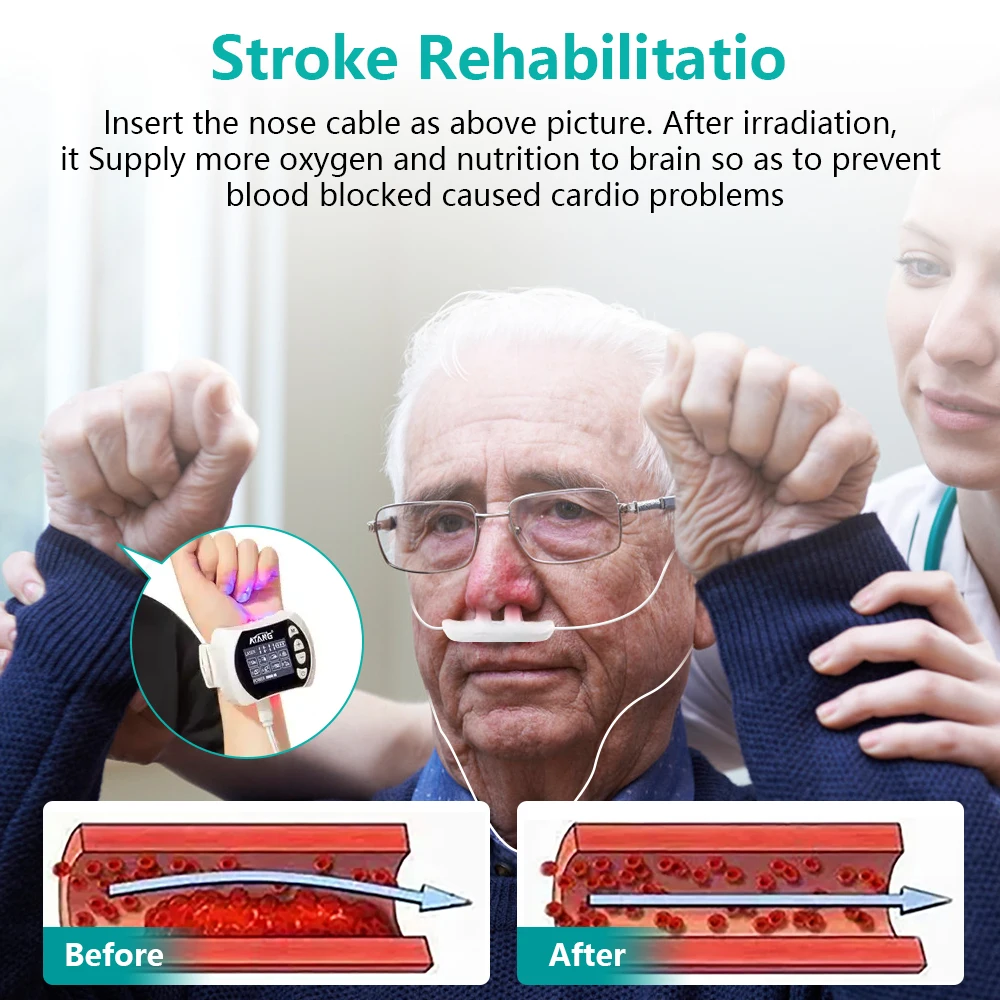 ATANG Promote blood circulation wrist watch blood glucose meter EMS equipment diabetes care laser treatment watch