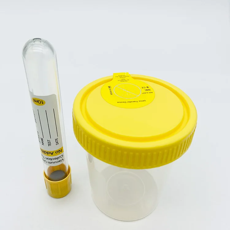 Высококачественный одноразовый сборщик мочи контейнер для образцов с иглами вакуумный набор