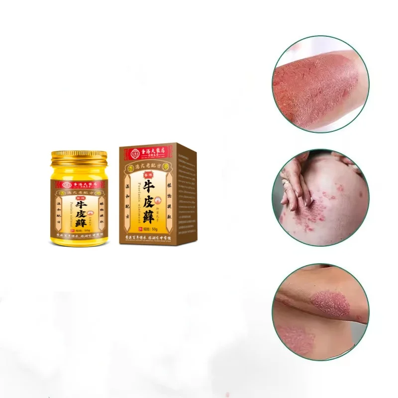 Psoriasis Cream Eczema Natural Herbal  Per Cure Scalp Dry Skin Care Products Against Psoriasis Ointment 50g