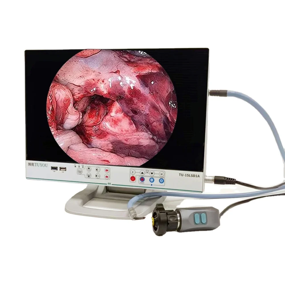 15.6-Inch Light Source Video Recording 3-In-1 Endoscope Camera