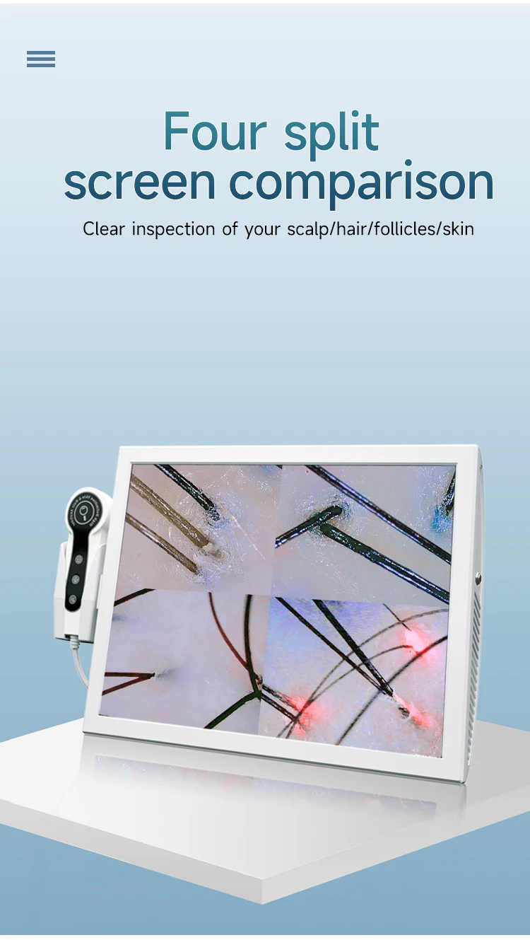Face and Scalp Analyzer Skin Analyzer Professional Scalp detector HD salon