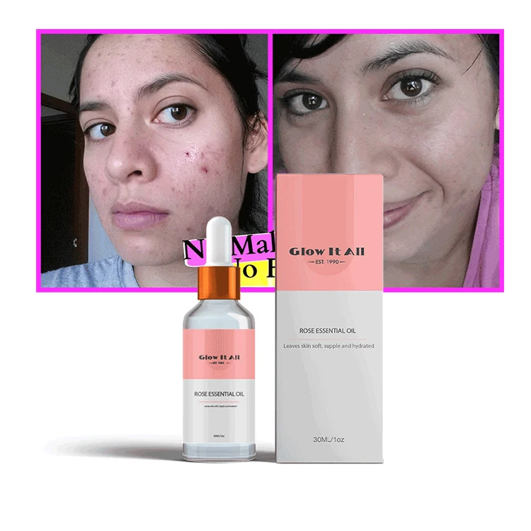 OEM ODM миндальное масло для кожи органическое увлажняющее массажное натуральное веганское дружественное масло для лица