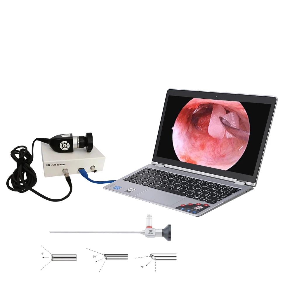medical mini camera usb hd 1080p  surgery camera system for ent sinuscope
