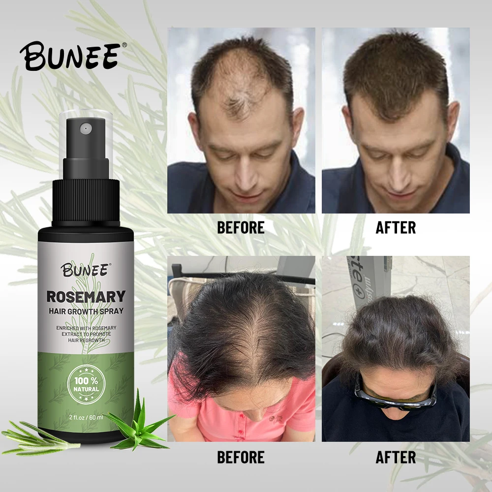 Private Label 120ml Natural Deep Hydrating Rice Water Rosemary Extract Hair Spray for Hair Growth with Biotin