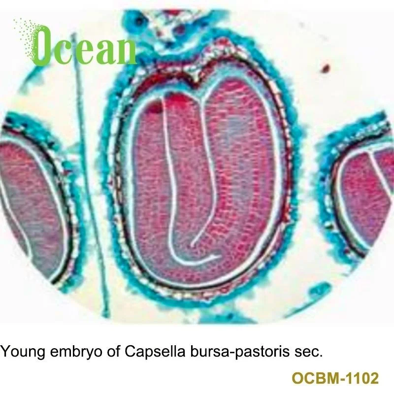 Young embryo of Capsella bursa-pastoris sec. prepared microscope