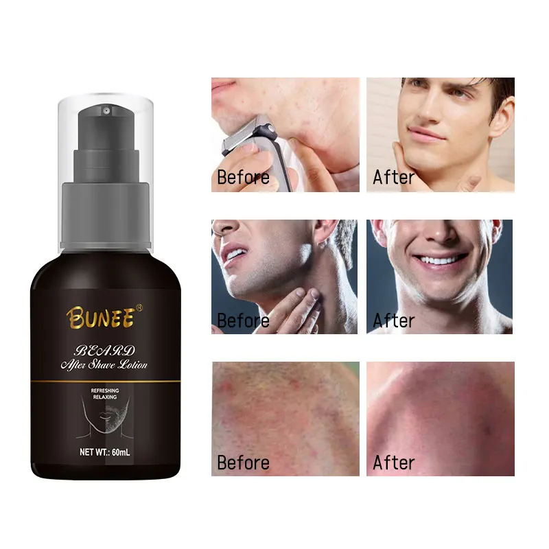 OEM Customized Men Care Lotion Hydrating And Nourishing After Shave