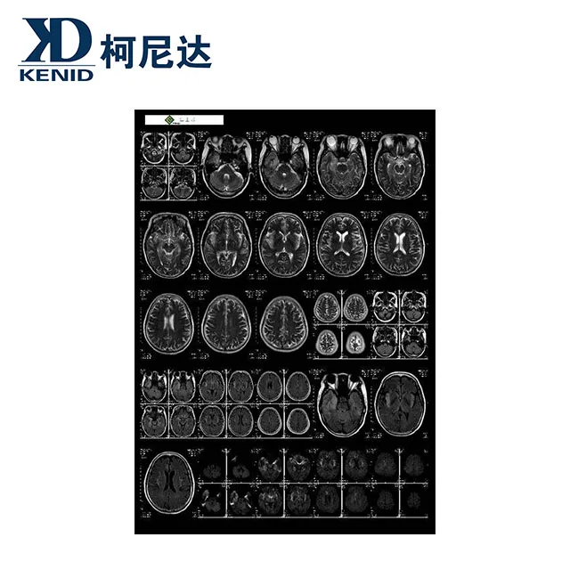china supplier manufacturer dry imaging film x ray film scrap for sale